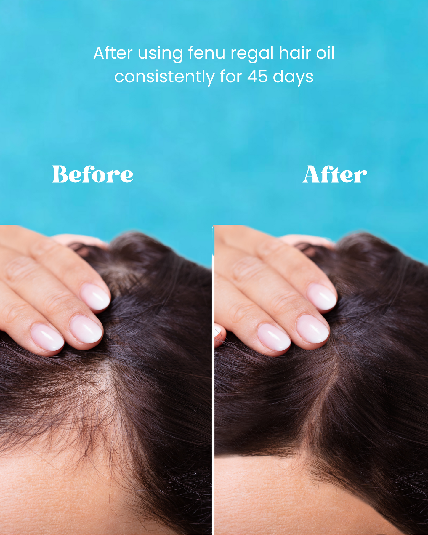 Fenu Regal Infusion Hair Oil - 150ml