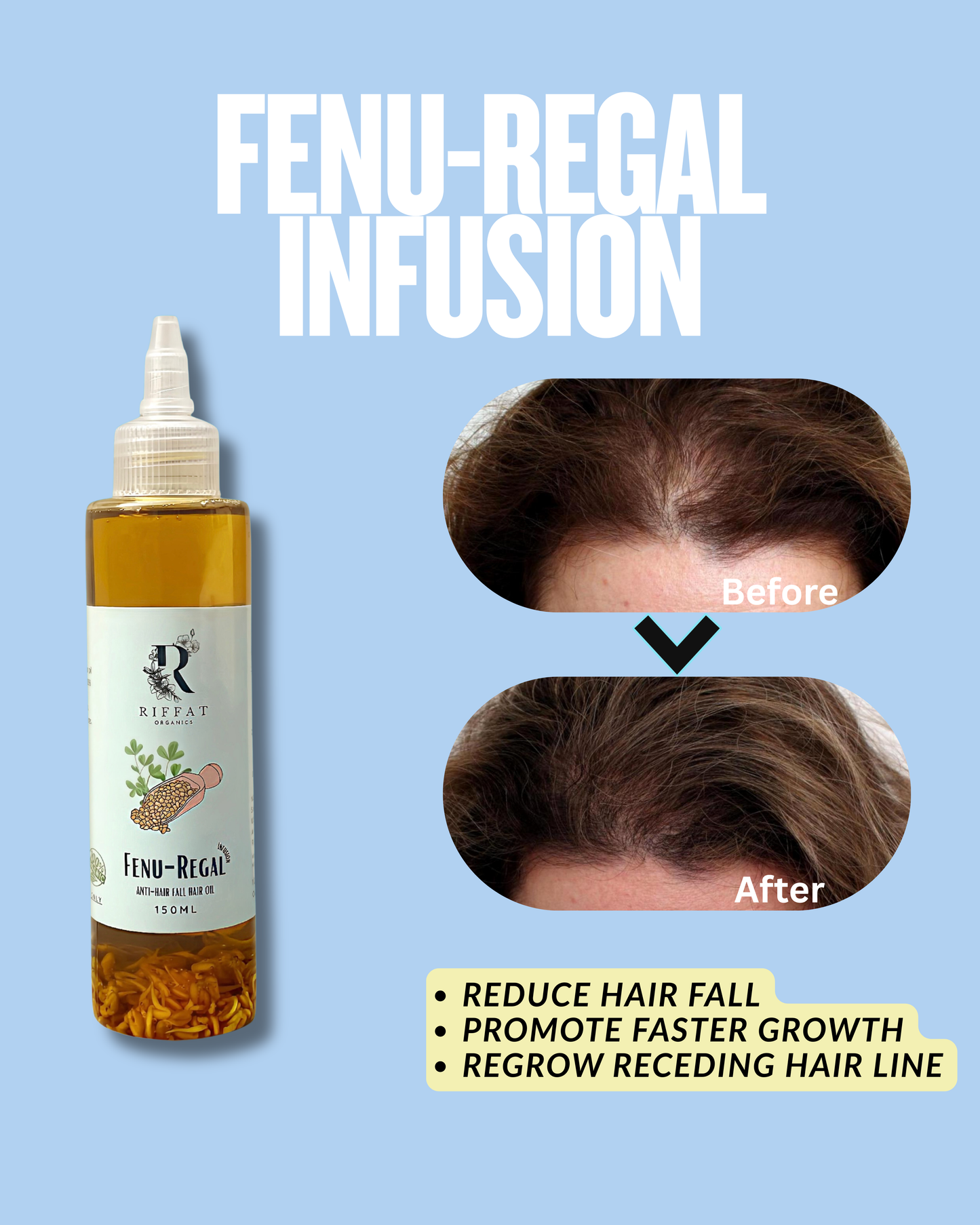 Fenu Regal Infusion Hair Oil - 150ml