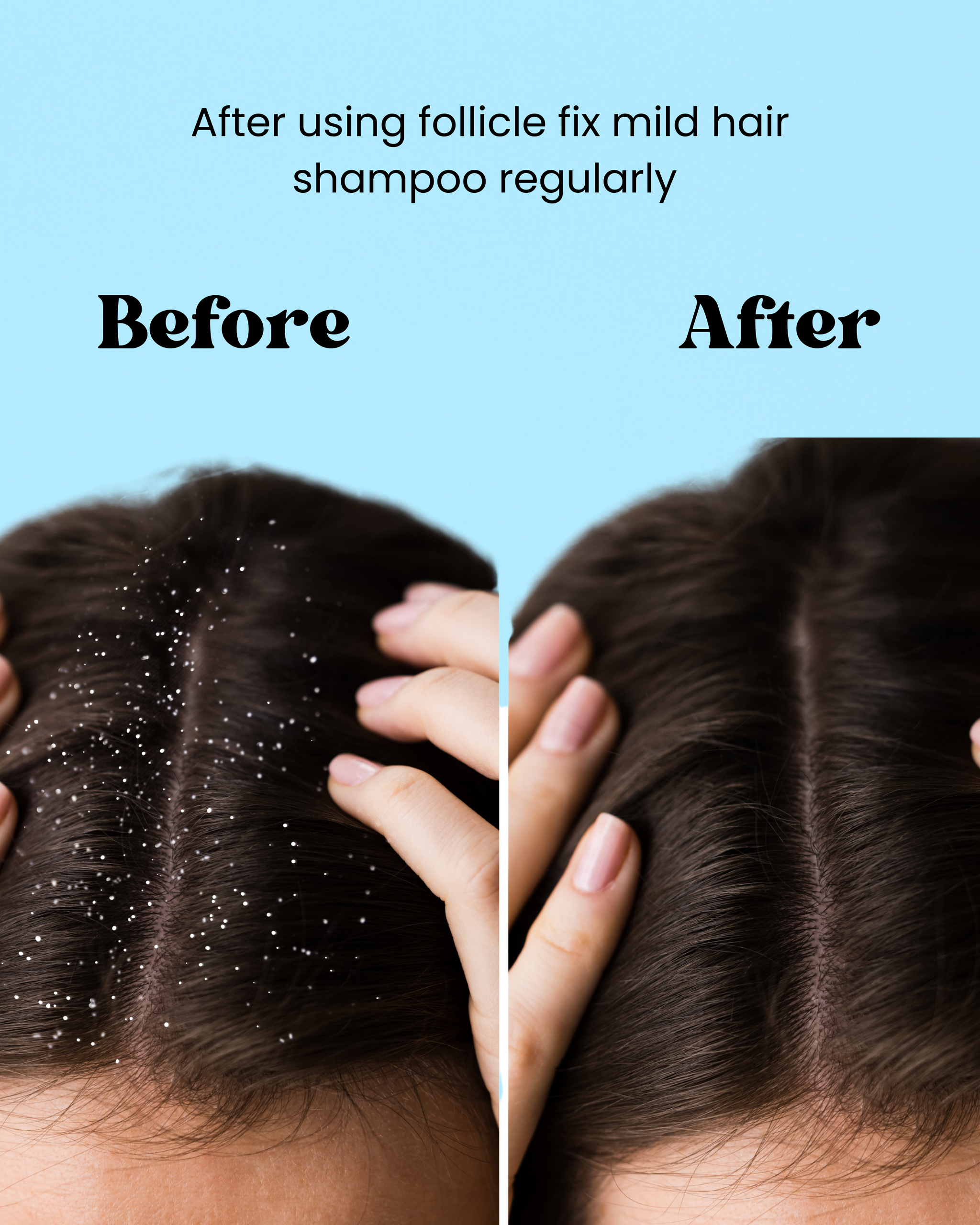 Follicle Fix Mild Shampoo - 200ml