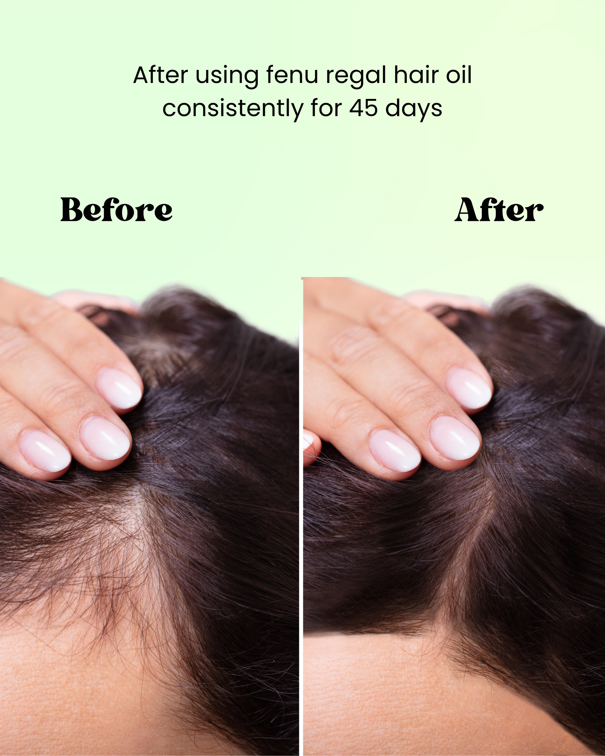Anti Hair Fall Oil - 150ml